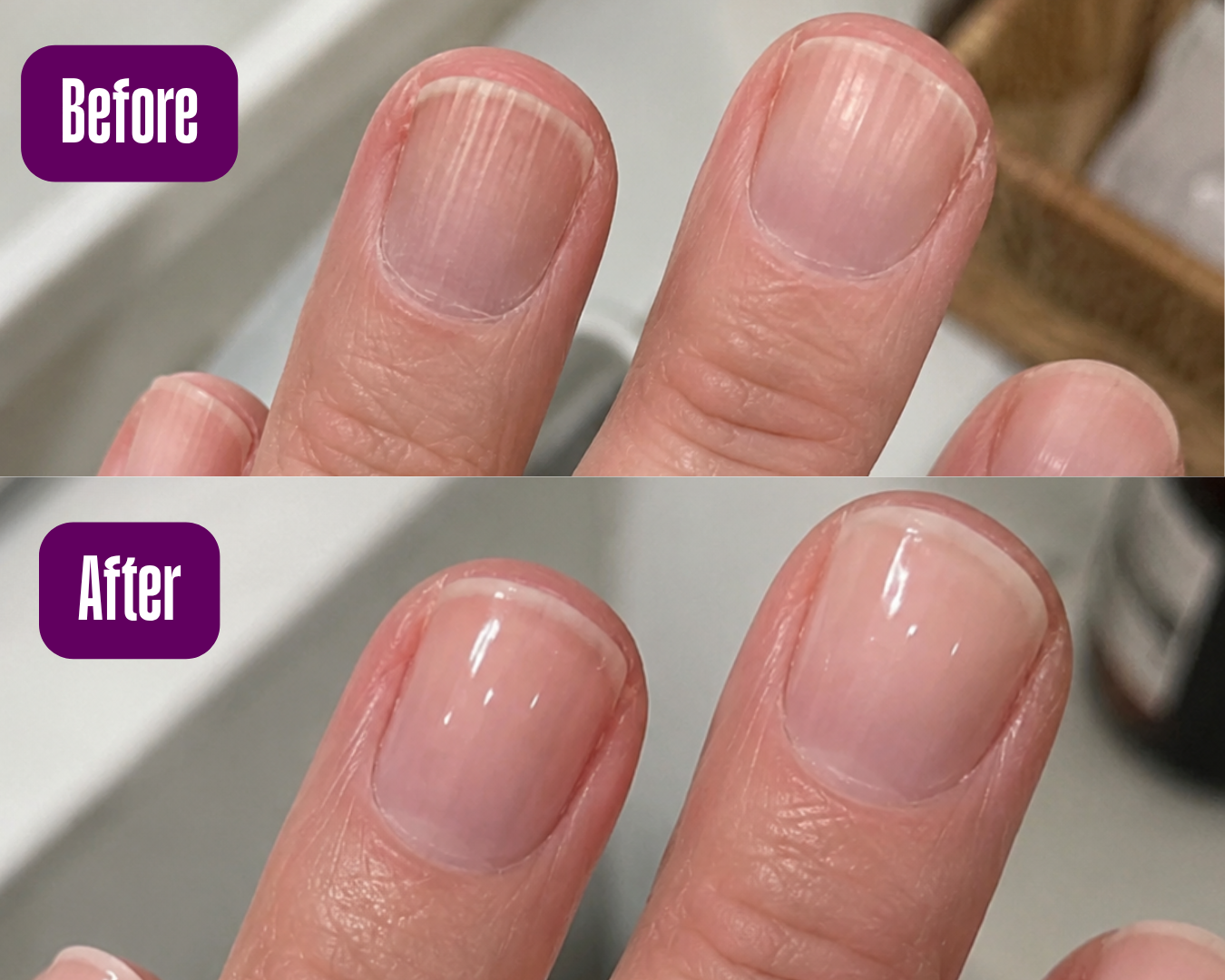 Nail Treatment - Smoothing Ridge Filler